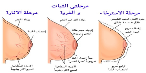 طرق اثارة المراة بالصور , كيف تكون المراه مثيره